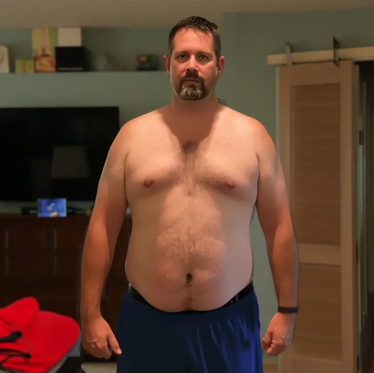 edisontcrux_before_and_after_weight_loss_picture_of_a_man_in_hi_e3ab3cbb-c21a-4f75-852e-230ed54f40df